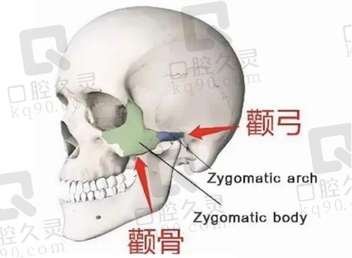 对比北京磨骨有名的医生：张笑天/何照华/黄大勇