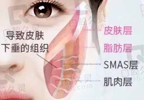 北京童仁清采医生SMAS深筋膜线雕术