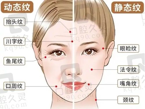 重庆李喆眼周筋膜提升成效怎样？