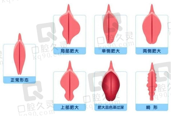 武汉同济医学院成佩医生简介