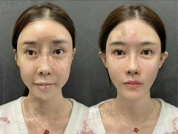 北京王阔远预约挂号