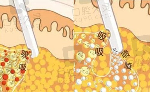 曲靖韩美李武龙医生擅长吸脂塑形