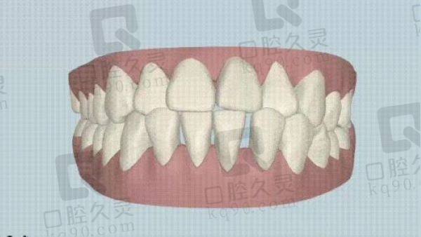 上海闵行区口腔便宜又好的牙科医院有哪些