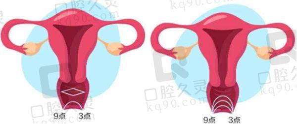 杭州生殖中心医院排名