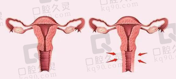 女性私密