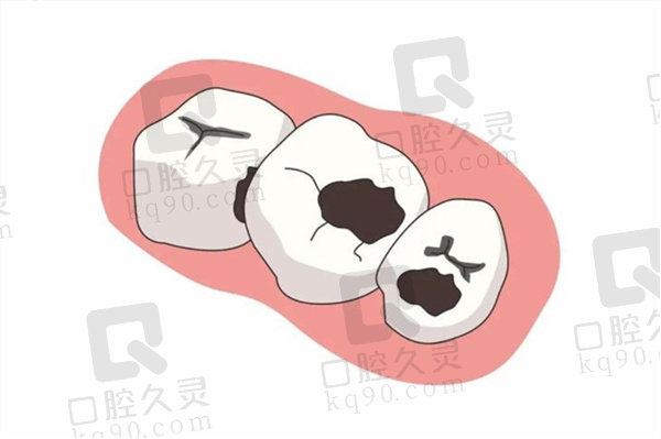临沂壹颗芽口腔医院做全瓷嵌体多少钱一颗