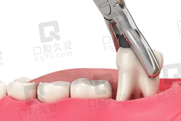 德州口腔医院拔牙价格