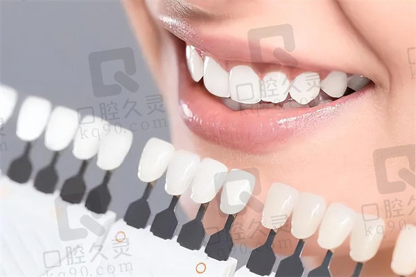 广州柏德口腔冷光美白价格