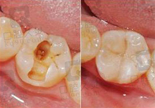 兴化三叶草口腔医院怎么样
