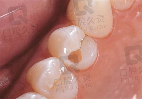 兴化三叶草口腔医院怎么样
