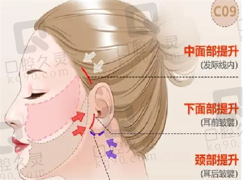 成都刘远程医生费用一般多少