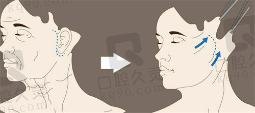 成都刘远程医生口碑咋样