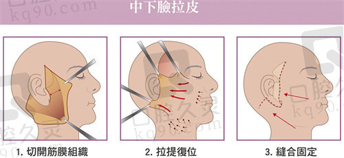 成都刘远程医生是正规还是仿
