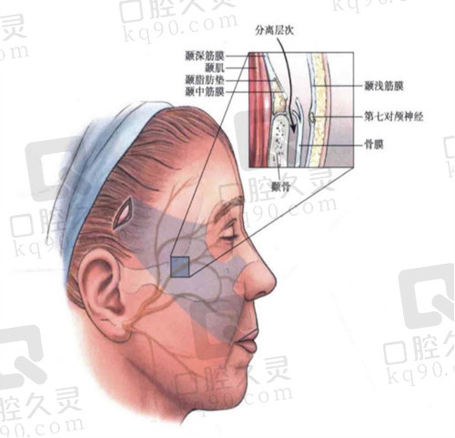 成都刘远程医生怎么样