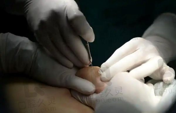 广州市荔湾区人民医院取奥美定怎么样