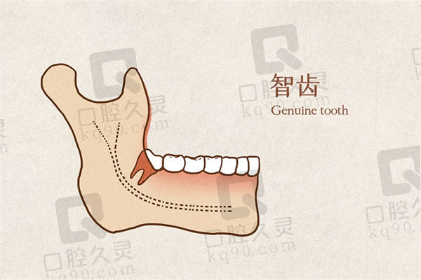 临海麦尔口腔医院能拔智齿吗？
