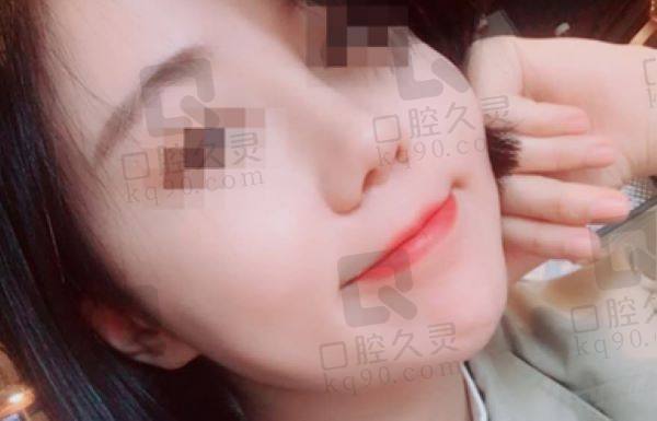 国内十大正规鼻修复医院排名