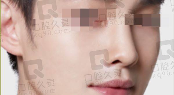 北京斯嘉丽医院鼻修复怎么样