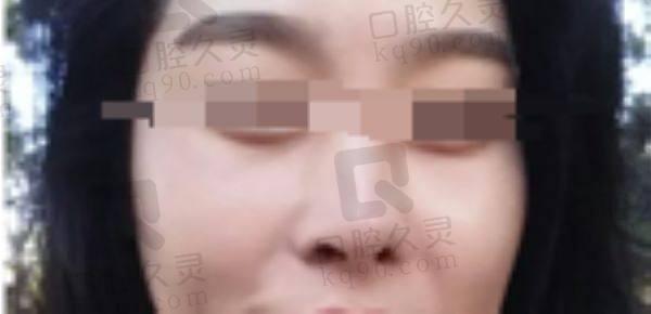 上海华美鼻修复怎么样