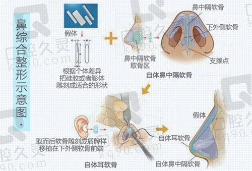 邓裴擅长做什么样的鼻子