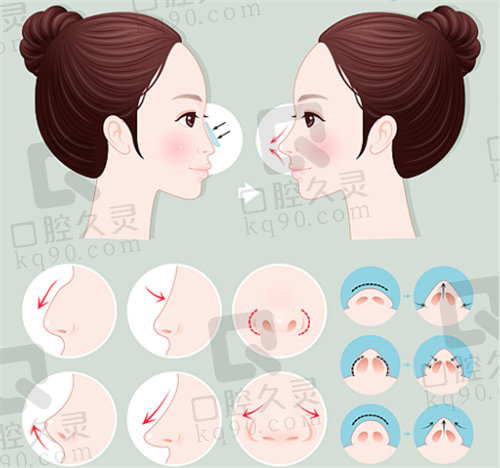 邓裴擅长做什么样的鼻子