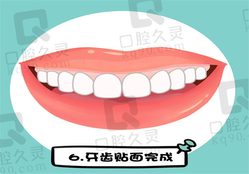 刘坦正畸水平实例 刘坦正畸水平实例