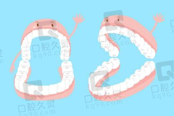 无锡全口假牙多少钱