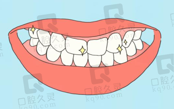 无锡全口假牙好的医院有哪些
