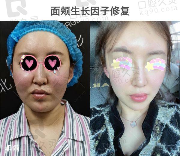 广州市荔湾中心医院异物取出多少钱