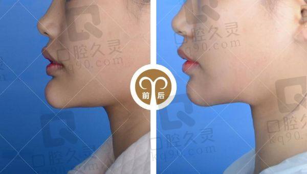广州市荔湾中心医院异物取出怎么样