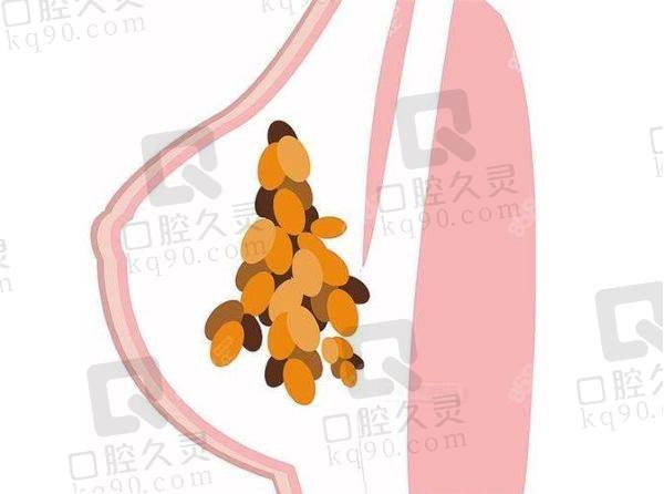 广州市荔湾中心医院价格表