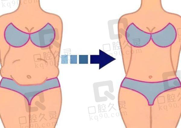 李献和腹壁手术的真实实例