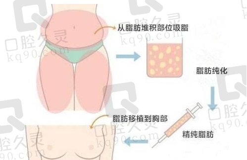 孙泽芳脂肪移植医生在线预约