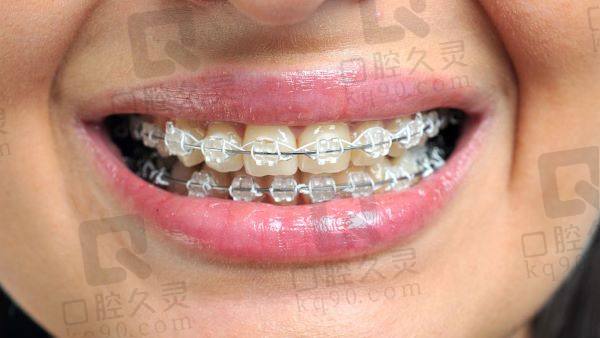 北大口腔醫(yī)院兒童牙齒矯正醫(yī)生介紹