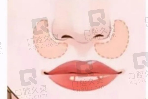 上海時(shí)光瞿健做鼻子真人實(shí)例測評