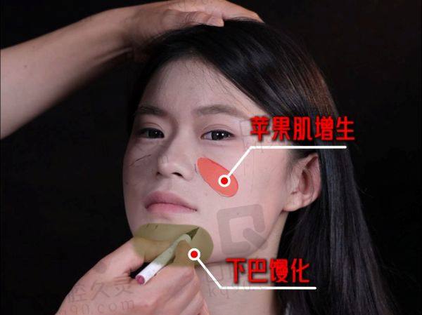 广州海峡彭栋梁院长做鼻子异物取出价格
