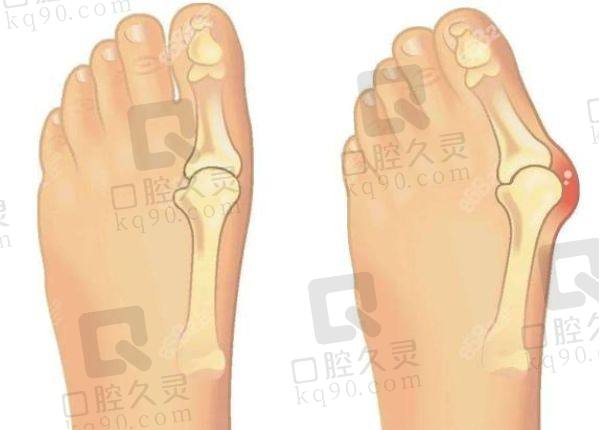 北京圣嘉新足雕怎么样