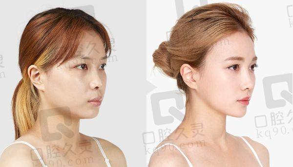 成都大象致颜医疗美容是渠道医院吗