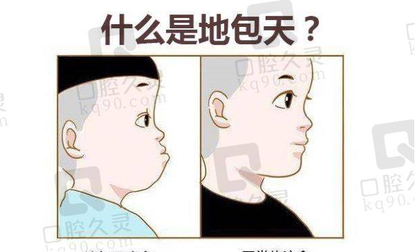 广州广大何锦泉地包天矫正怎么样