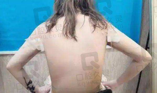 成都军大全身吸脂价格