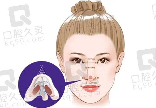王旭明醫(yī)生鼻子做的好嗎？