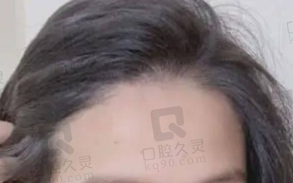 东莞台心医院植发科怎么样