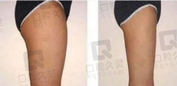 上海华美何斌医生口碑好吗