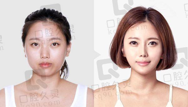 李志海磨骨是什么風(fēng)格
