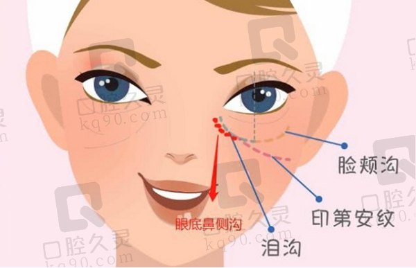 魏志香眼修复价格参考