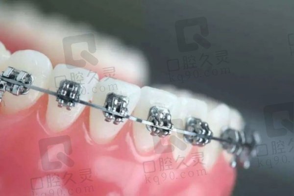 宝鸡大团圆口腔医院做青少年矫正的优势