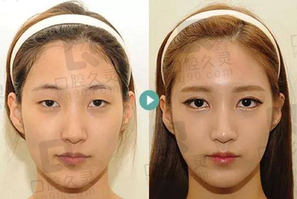 宋桂霞眼睛属于什么档次