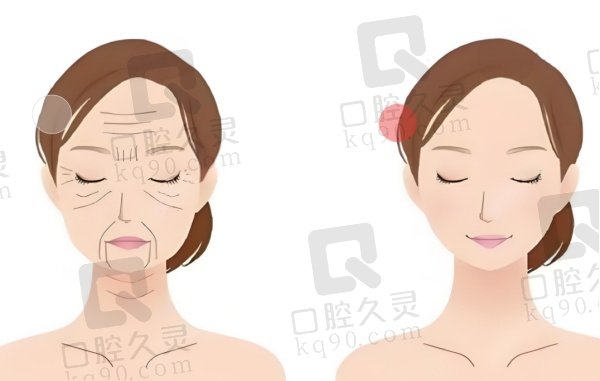 蒲兴旺医生能做五层提升术吗