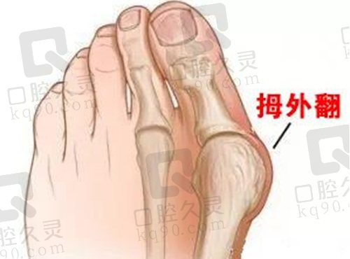 广州广大陈碧顺医生擅长项目