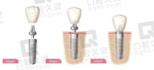 香港看牙齒哪家醫院好